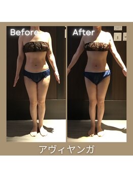 ソレイユ/アーユルヴェーダ痩身