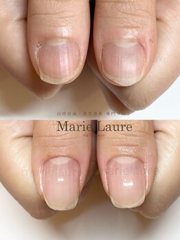 マリーロール 淀屋橋本店(Marie Laure)/自爪育成/深爪矯正/ネイルケア