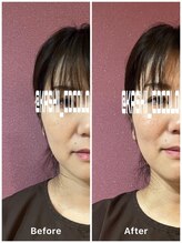 ココロ(CoCoLo)/ビフォーアフター