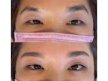 ローナ(Lorna)の雰囲気（自己処理前にサロンで処理が最適解＊）