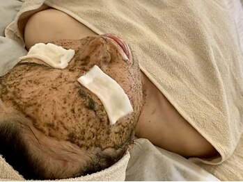 レア(Lea)の写真/【隠れ家サロン】100%天然成分の商材を使用しお悩み別にお肌をケア!肌トラブルを改善し理想の肌に導きます!