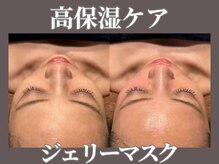 マヴィ 高槻店(MavY.)/ぷるんと弾むジェリーマスク