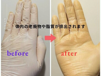 ボディケアルーム リフレキュア 中野(REFLECURE)の写真