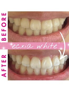 エクシアホワイト 倉吉店(ecxia white)/ビフォーアフター