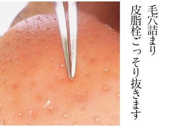 モミン(MOMI.N)の写真/シミもくすみもなかったことに、光の力で肌を一新し透明感あふれる美肌へ導くケア60分4950円