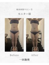 巴 松茂店/1回でもここまで変わる