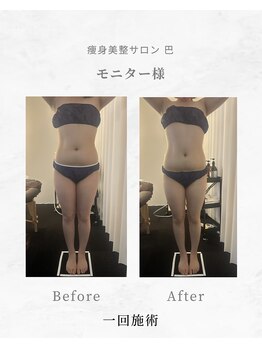 巴 松茂店/1回でもここまで変わる