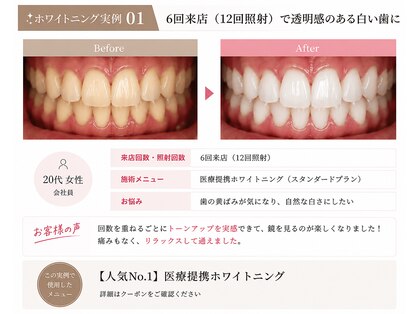 ホワイトニングショップ 霧島店の写真
