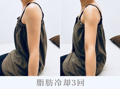 脂肪冷却LABOの写真