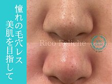 リコ フェリーチェ(Rico Feliche)の雰囲気（SNSで話題の毛穴エクストラクションで いちご鼻卒業[毛穴ケア]）