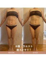 エイミー 藤ヶ丘店(Amy)/before→after