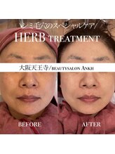 アンク(Ankh)/ハーブ BEFORE & AFTER