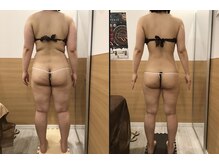リッツ 草加店(Ritz)/【Before/After】痩身