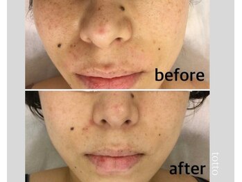 サロントット(salon totto)/before→after