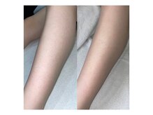 サロン ド スカイ(Salon de sky)/女性・脚