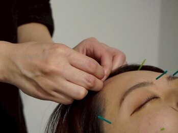 ルーロ サロン(LooLo salon)の写真/新しいアプローチの鍼灸Salonが円山に登場!〈美容鍼＋ボディ鍼灸施術〉で美しく健康な毎日をプロデュース!