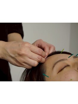 鍼灸施術を受けたい