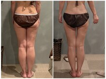 ツーアップ(2up)/内もも隙間、ふくらはぎほっそり