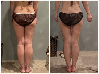 ツーアップ(2up)/内もも隙間、ふくらはぎほっそり