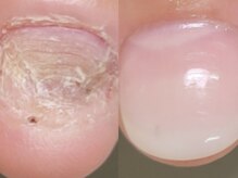 グレースレディ 大阪店の雰囲気(とりあえず綺麗な爪へ【自爪育成/長さだし/深爪/フィルイン】)