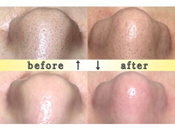 ディエール(Diailes)