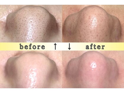 ディエール(Diailes)の写真