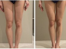 マール(Mar)/骨格矯正　痩身/むくみ/阿佐ヶ谷