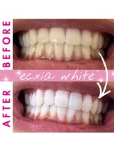 エクシアホワイト 倉吉店(ecxia white)/ビフォーアフター