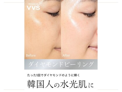 マインエム(mine.m)の写真