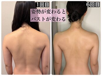 ハーズプラス(hers+)の写真/背中のコリを解消し、憧れのボディラインへ☆姿勢が変わればバストもUP！若々しい印象に♪（40文字）