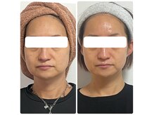 リノ(Lino)の雰囲気（超ド級～♪表情筋を内側からしっかり鍛えてグングンと小顔に♪）
