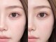 アルーシェ 船堀店(Alushe)の写真