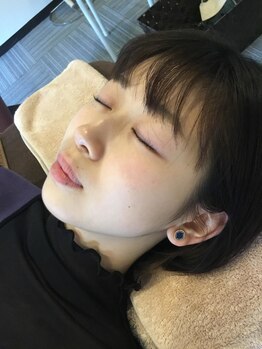 チキバン美容鍼灸整体サロン 心斎橋店/シミケア