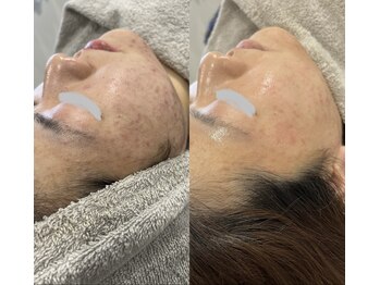 アイアール(ir)/