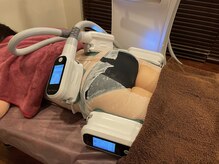ユー(U)/脂肪冷却　4CUP　腰肉・外もも