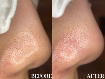 サロン ムスブ(salon MUSUBU)/山梨エステ/甲府エステ