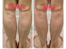 ビンナ 五反田店(Binna)/血流促進ケア