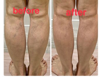 ビンナ 五反田店(Binna)/血流促進ケア