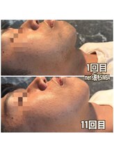 シンバ 倉敷店(SIMBA)/