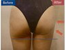 【全身ケア♪美ボディを創る】パワーレメディ120min♪¥21000→