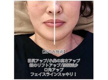 ココオーブ(COCO AUBE)の雰囲気（顔のたるみ改善・小顔になるには、首と肩からのドライヘッドスパ）