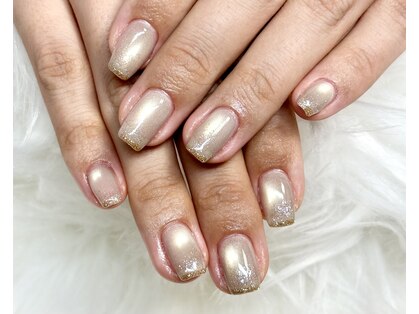 マイオティック ネイル(miotic nail)の写真