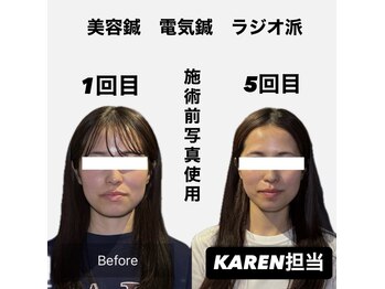 クリアランス(CLEARANCE)/施術回数5回　KAREN