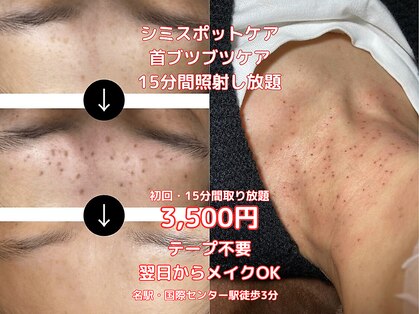 ミロク(369)の写真