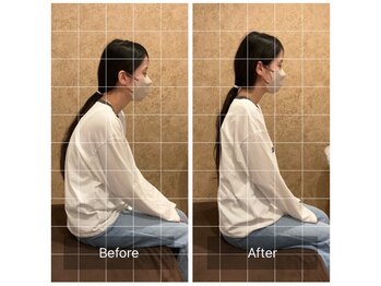 トラスト整体院 小池院/40代/女性/会社員/巻き肩