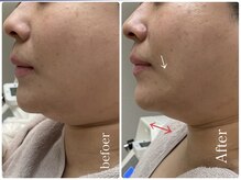 リッチベル(richbelle)の雰囲気(レッドショット2cc導入初回40代)