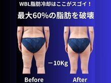 ホワイトビューティーラボ(White Beauty Lab)