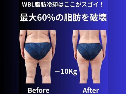 ホワイトビューティーラボ(White Beauty Lab)の写真