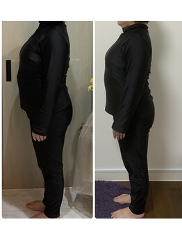 ヨサ パーク コアハート(YOSA PARK CORE HEART)/1回でこの違い！