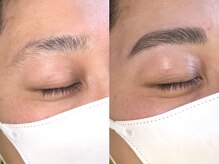 キャンバス 初台(CANVAS)/- Men's HBL - &nbsp;Before/After